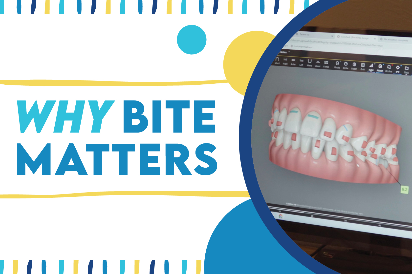 Why Bite Matters | Love Orthodontics